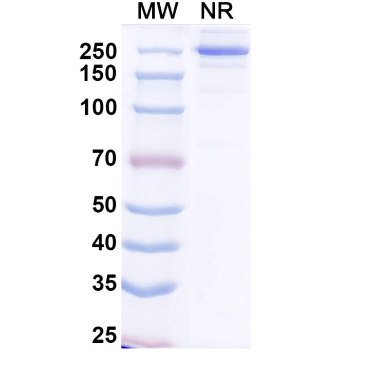 SDS-PAGE - Ogalvibart Biosimilar - Anti-SARS-CoV-2 Spike Protein RBD Antibody - BSA and Azide free (A339233) - Antibodies.com