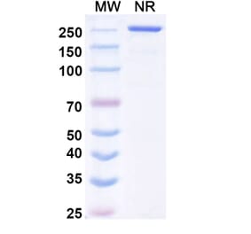 SDS-PAGE - Mecbotamab Biosimilar - Anti-Axl Antibody - BSA and Azide free (A339237) - Antibodies.com