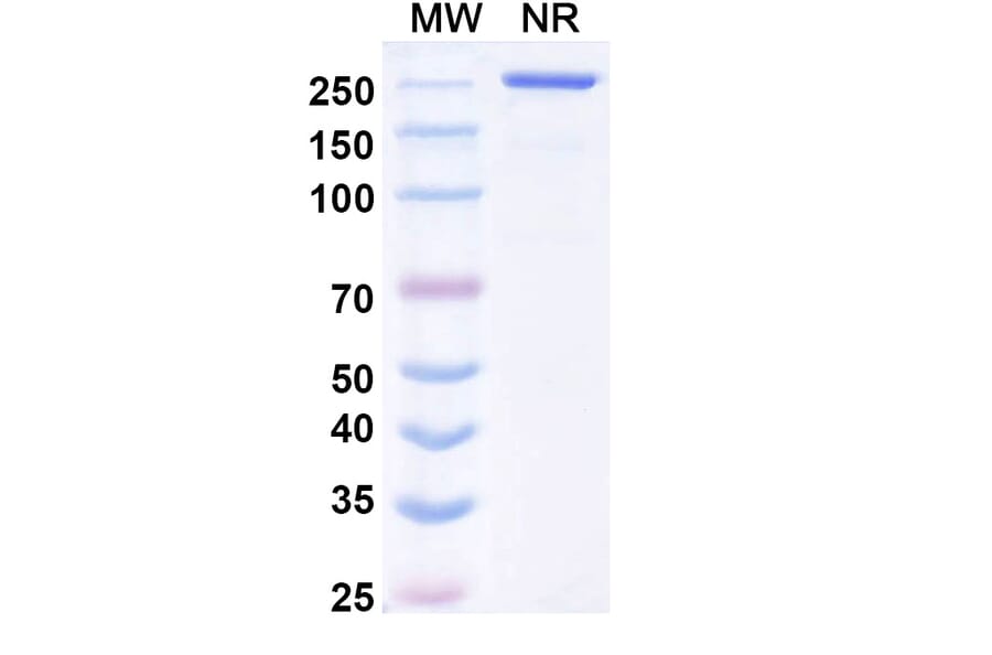 SDS-PAGE - Mecbotamab Biosimilar - Anti-Axl Antibody - BSA and Azide free (A339237) - Antibodies.com