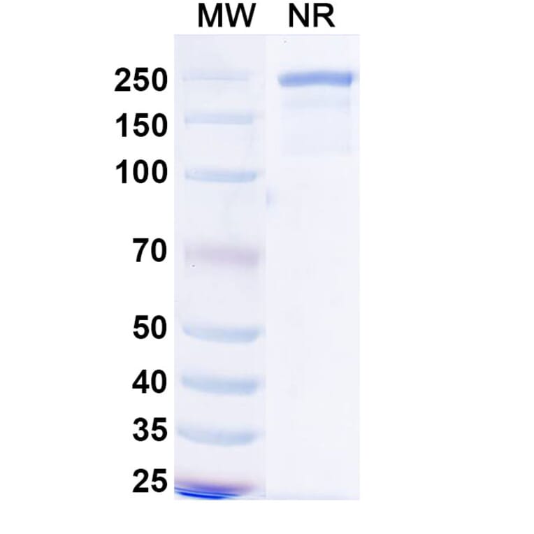 SDS-PAGE - Mecbotamab Biosimilar - Anti-Axl Antibody - BSA and Azide free (A339237) - Antibodies.com