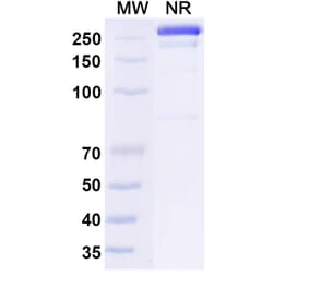 SDS-PAGE - Osemitamab Biosimilar - Anti-Claudin18 Antibody - BSA and Azide free (A339238) - Antibodies.com