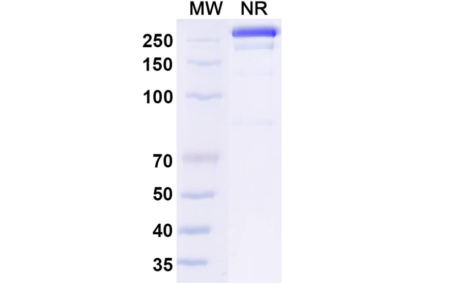 SDS-PAGE - Osemitamab Biosimilar - Anti-Claudin18 Antibody - BSA and Azide free (A339238) - Antibodies.com