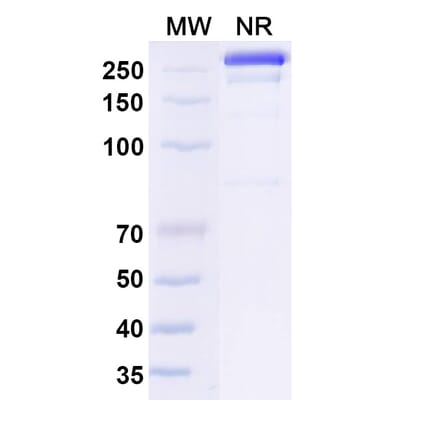SDS-PAGE - Osemitamab Biosimilar - Anti-Claudin18 Antibody - BSA and Azide free (A339238) - Antibodies.com