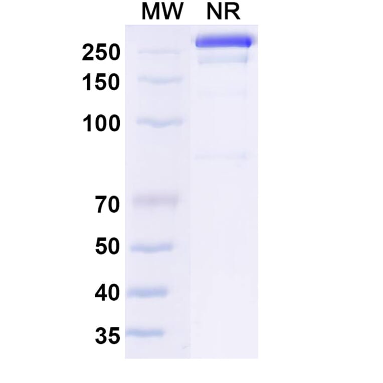 SDS-PAGE - Osemitamab Biosimilar - Anti-Claudin18 Antibody - BSA and Azide free (A339238) - Antibodies.com