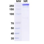 SDS-PAGE - Osemitamab Biosimilar - Anti-Claudin18 Antibody - BSA and Azide free (A339238) - Antibodies.com