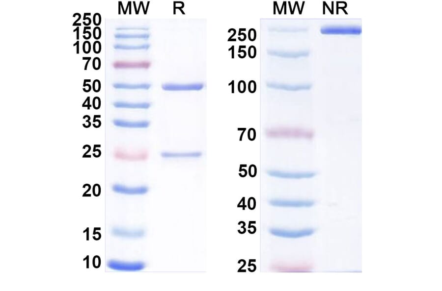 SDS-PAGE - Ozuriftamab Biosimilar - Anti-ROR2 Antibody - BSA and Azide free (A339239) - Antibodies.com