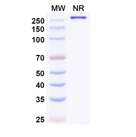 SDS-PAGE - Paridiprubart Biosimilar - Anti-TLR4 Antibody - BSA and Azide free (A339240) - Antibodies.com