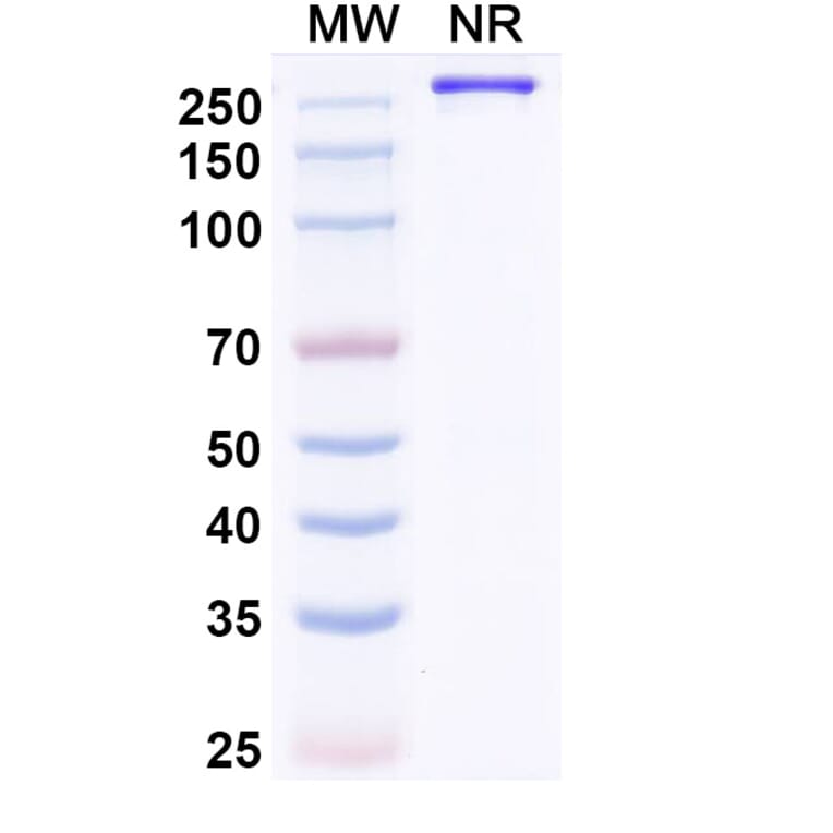 SDS-PAGE - Paridiprubart Biosimilar - Anti-TLR4 Antibody - BSA and Azide free (A339240) - Antibodies.com