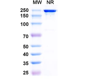 SDS-PAGE - Posdinemab Biosimilar - Anti-Tau Antibody - BSA and Azide free (A339241) - Antibodies.com