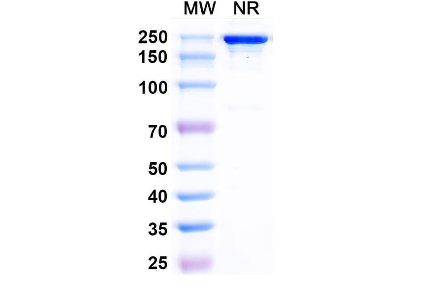 SDS-PAGE - Posdinemab Biosimilar - Anti-Tau Antibody - BSA and Azide free (A339241) - Antibodies.com