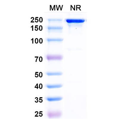 SDS-PAGE - Posdinemab Biosimilar - Anti-Tau Antibody - BSA and Azide free (A339241) - Antibodies.com
