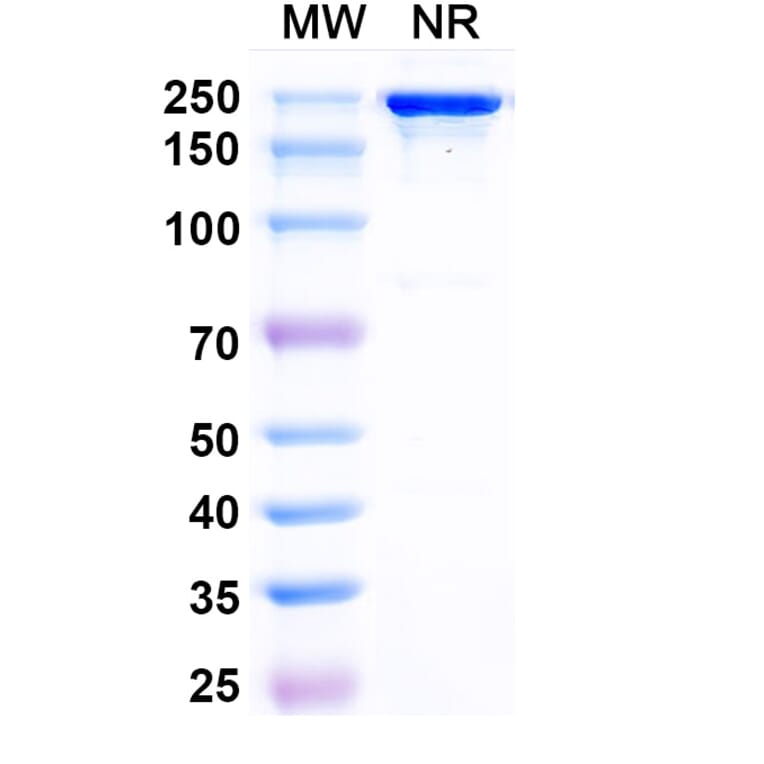 SDS-PAGE - Posdinemab Biosimilar - Anti-Tau Antibody - BSA and Azide free (A339241) - Antibodies.com