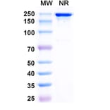 SDS-PAGE - Posdinemab Biosimilar - Anti-Tau Antibody - BSA and Azide free (A339241) - Antibodies.com