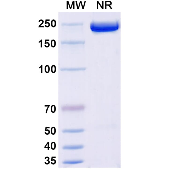 SDS-PAGE - Apitegromab Biosimilar - Anti-Myostatin Antibody - BSA and Azide free (A339245) - Antibodies.com
