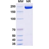 SDS-PAGE - Apitegromab Biosimilar - Anti-Myostatin Antibody - BSA and Azide free (A339245) - Antibodies.com