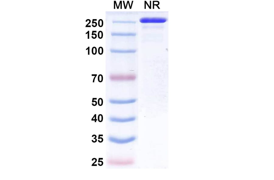 SDS-PAGE - Suciraslimab Biosimilar - Anti-CD22 Antibody - BSA and Azide free (A339247) - Antibodies.com