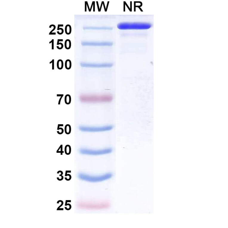 SDS-PAGE - Suciraslimab Biosimilar - Anti-CD22 Antibody - BSA and Azide free (A339247) - Antibodies.com