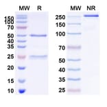 SDS-PAGE - Theralizumab Biosimilar - Anti-CD28 Antibody - BSA and Azide free (A339248) - Antibodies.com