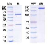 SDS-PAGE - Anti-PVRIG Antibody [GSK4381562] Biosimilar - BSA and Azide free (A339272) - Antibodies.com