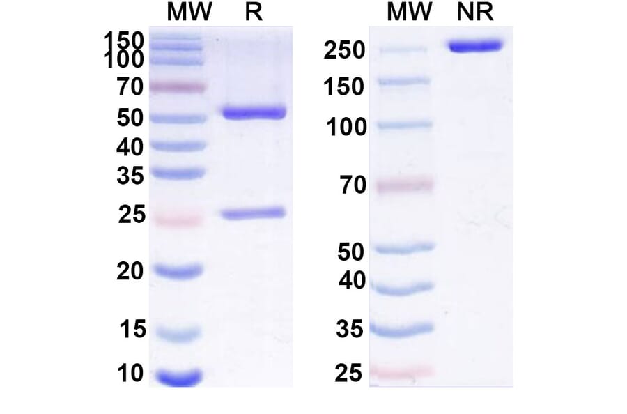 SDS-PAGE - Anti-GAS6 Antibody [KM532] Biosimilar - BSA and Azide free (A339274) - Antibodies.com