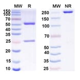 SDS-PAGE - Anti-GAS6 Antibody [KM532] Biosimilar - BSA and Azide free (A339274) - Antibodies.com