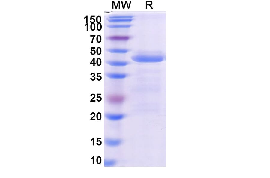 SDS-PAGE - Ensovibep Biosimilar - Anti-SARS-CoV-2 Spike Protein RBD Antibody - BSA and Azide free (A339279) - Antibodies.com