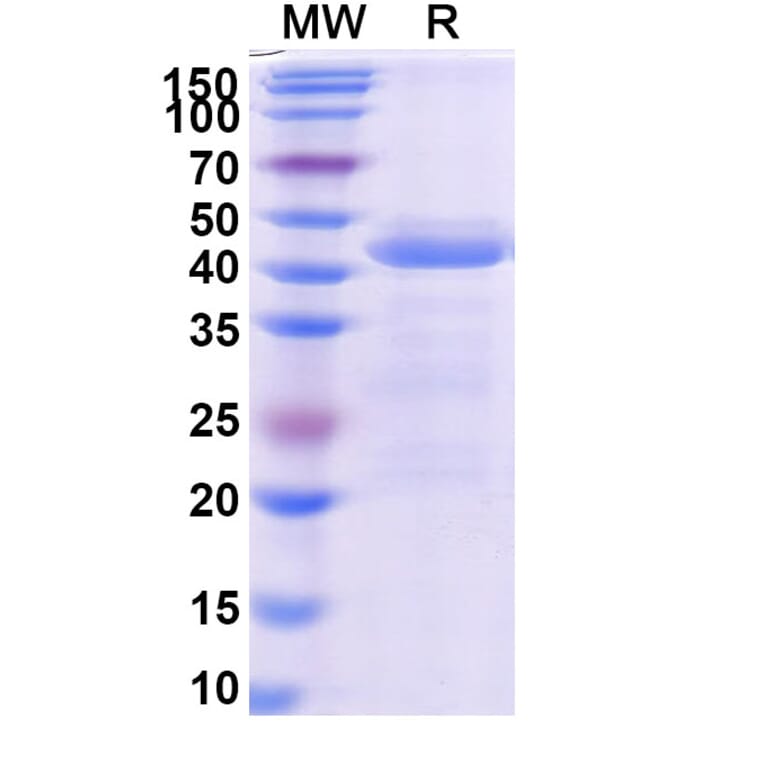 SDS-PAGE - Ensovibep Biosimilar - Anti-SARS-CoV-2 Spike Protein RBD Antibody - BSA and Azide free (A339279) - Antibodies.com