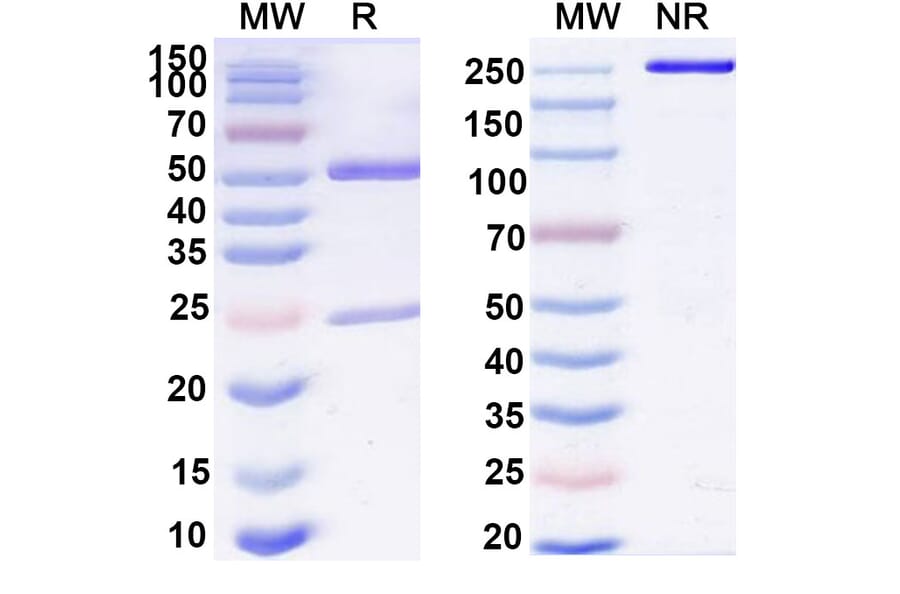 SDS-PAGE - Anti-IL-11RA Antibody [X29] Biosimilar - BSA and Azide free (A339284) - Antibodies.com