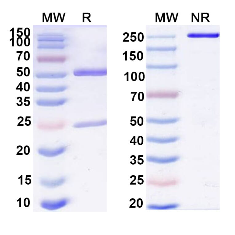 SDS-PAGE - Anti-IL-11RA Antibody [X29] Biosimilar - BSA and Azide free (A339284) - Antibodies.com