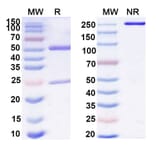 SDS-PAGE - Anti-IL-11RA Antibody [X29] Biosimilar - BSA and Azide free (A339284) - Antibodies.com