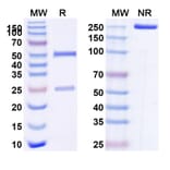SDS-PAGE - Anti-CD96 Antibody [GSK69768] Biosimilar - BSA and Azide free (A339286) - Antibodies.com