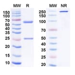 SDS-PAGE - Anti-VISTA Antibody [HMBD-2] Biosimilar - BSA and Azide free (A339287) - Antibodies.com