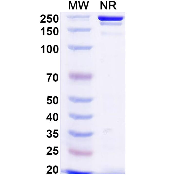 SDS-PAGE - Anti-TREM2 Antibody [al2] Biosimilar - BSA and Azide free (A339290) - Antibodies.com