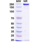 SDS-PAGE - Anti-TREM2 Antibody [al2] Biosimilar - BSA and Azide free (A339290) - Antibodies.com