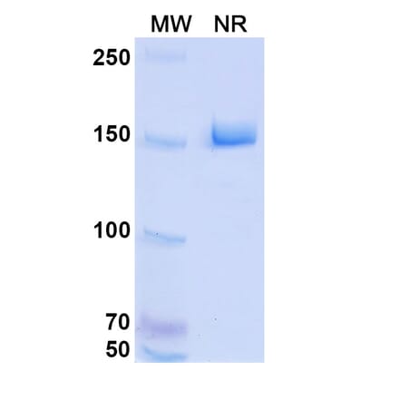 SDS-PAGE - HKT288 Biosimilar - Anti-Cadherin-6 Antibody - BSA and Azide free (A339297) - Antibodies.com