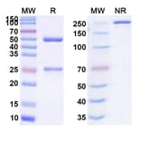 SDS-PAGE - Anti-CD73 Antibody [CM 326] Biosimilar - BSA and Azide free (A339313) - Antibodies.com