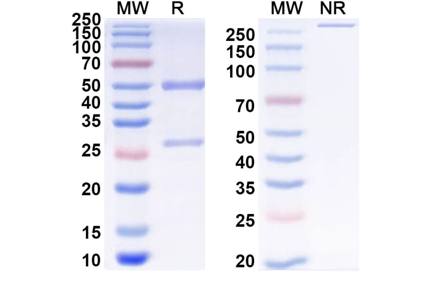 SDS-PAGE - Anti-ADAM17 Antibody [D8P1C1] Biosimilar - BSA and Azide free (A339320) - Antibodies.com