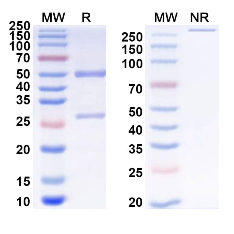 SDS-PAGE - Anti-ADAM17 Antibody [D8P1C1] Biosimilar - BSA and Azide free (A339320) - Antibodies.com