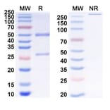 SDS-PAGE - Anti-ADAM17 Antibody [D8P1C1] Biosimilar - BSA and Azide free (A339320) - Antibodies.com