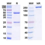 SDS-PAGE - Anti-ADAMTS5 Antibody [GSK23942] Biosimilar - BSA and Azide free (A339322) - Antibodies.com