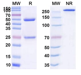 SDS-PAGE - Anti-Adrenomedullin Antibody [ART16] Biosimilar - BSA and Azide free (A339324) - Antibodies.com
