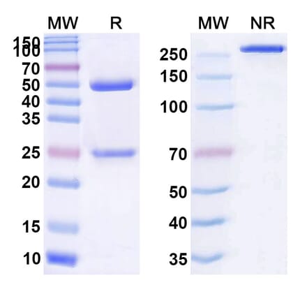 SDS-PAGE - Anti-Adrenomedullin Antibody [ART16] Biosimilar - BSA and Azide free (A339324) - Antibodies.com