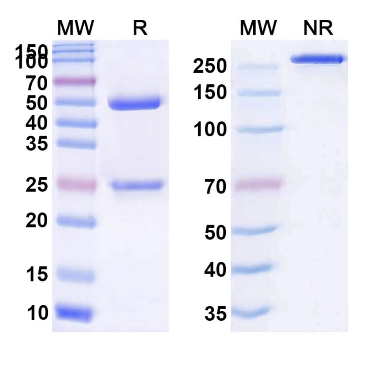 SDS-PAGE - Anti-Adrenomedullin Antibody [ART16] Biosimilar - BSA and Azide free (A339324) - Antibodies.com