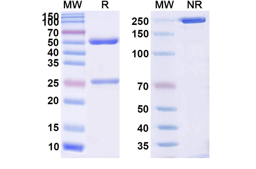 SDS-PAGE - Anti-ALK Antibody [DLX521] Biosimilar - BSA and Azide free (A339327) - Antibodies.com