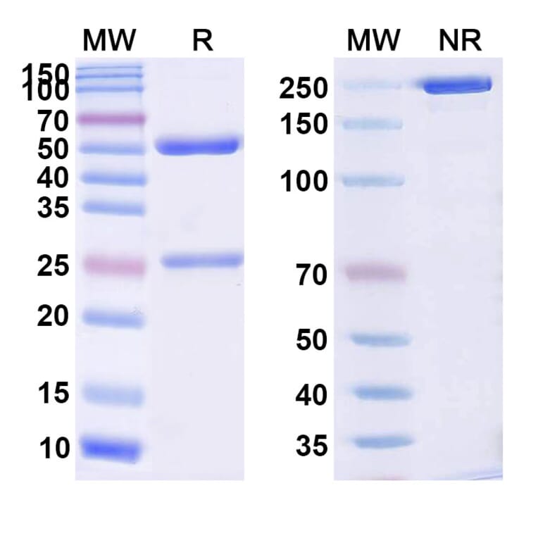 SDS-PAGE - Anti-Dystroglycan Antibody [DAG-6F4] Biosimilar - BSA and Azide free (A339328) - Antibodies.com