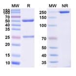 SDS-PAGE - Anti-Dystroglycan Antibody [DAG-6F4] Biosimilar - BSA and Azide free (A339328) - Antibodies.com