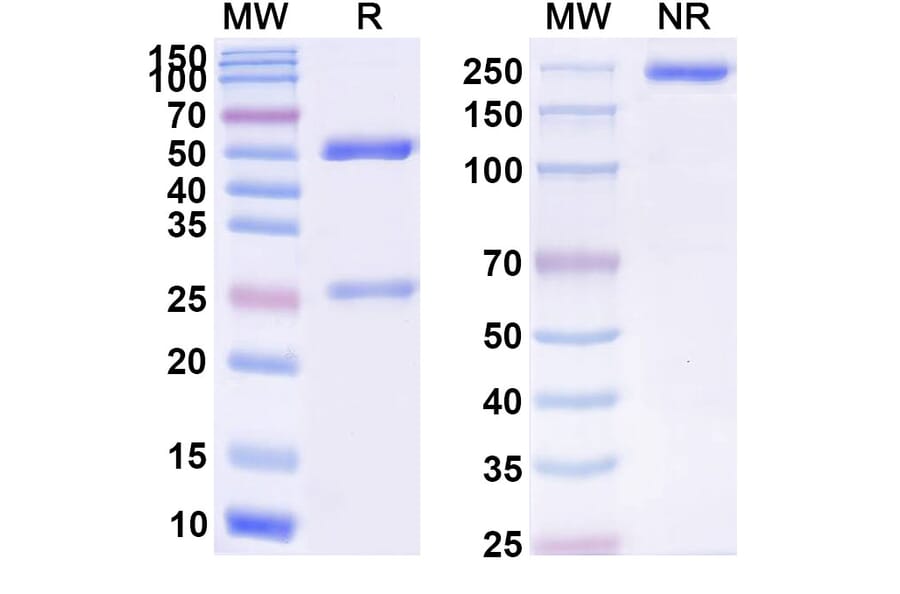 SDS-PAGE - Anti-APP Antibody [AD82] Biosimilar - BSA and Azide free (A339335) - Antibodies.com