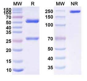 SDS-PAGE - Anti-APP Antibody [SAR22881] Biosimilar - BSA and Azide free (A339341) - Antibodies.com