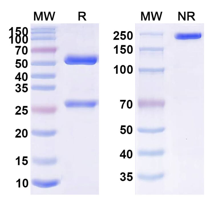 SDS-PAGE - Anti-APP Antibody [SAR22881] Biosimilar - BSA and Azide free (A339341) - Antibodies.com
