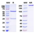 SDS-PAGE - Anti-ASGR1 Antibody [AMG 529] Biosimilar - BSA and Azide free (A339352) - Antibodies.com